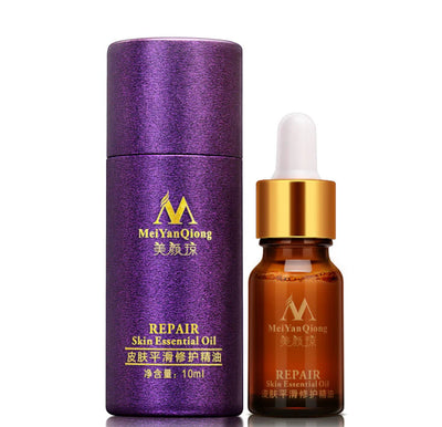 Renewing Skin Therapy Oil Lavender Infused Natural Care Blemish Relief Pure Formula Scar Reduction Stretch Mark Solution 10 ML