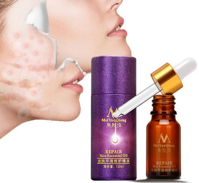 Renewing Skin Therapy Oil Lavender Infused Natural Care Blemish Relief Pure Formula Scar Reduction Stretch Mark Solution 10 ML
