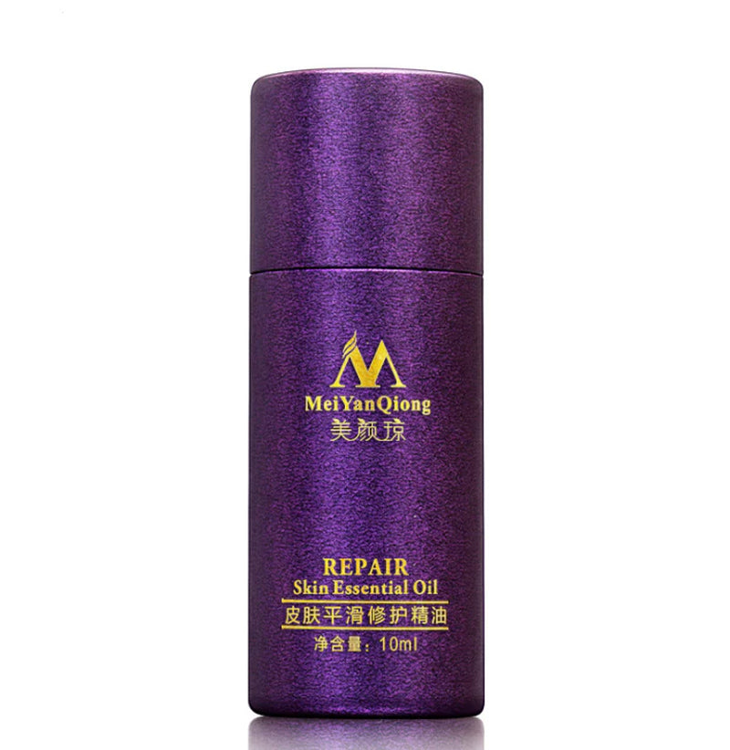 Renewing Skin Therapy Oil Lavender Infused Natural Care Blemish Relief Pure Formula Scar Reduction Stretch Mark Solution 10 ML