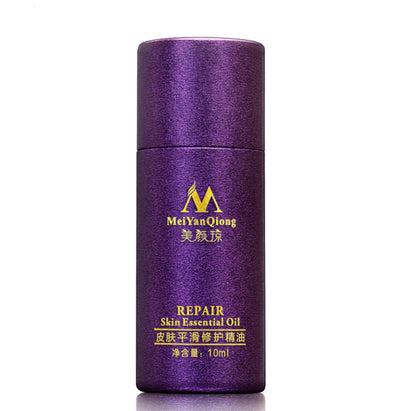 Renewing Skin Therapy Oil Lavender Infused Natural Care Blemish Relief Pure Formula Scar Reduction Stretch Mark Solution 10 ML