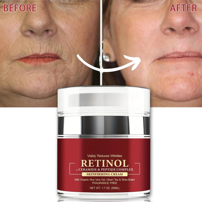 Instant Retinol Cream Wrinkle Remover Firming Lifting anti Aging Fade Fine Lines Moisturizing Whitening Korea Repair Skin Care