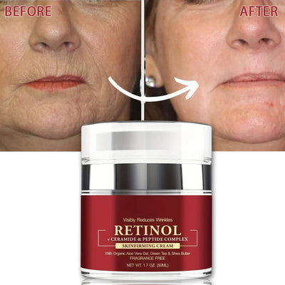 Instant Retinol Cream Wrinkle Remover Firming Lifting anti Aging Fade Fine Lines Moisturizing Whitening Korea Repair Skin Care