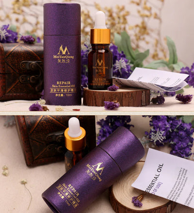 Renewing Skin Therapy Oil Lavender Infused Natural Care Blemish Relief Pure Formula Scar Reduction Stretch Mark Solution 10 ML