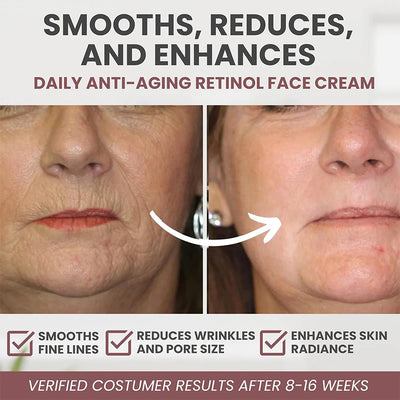 Instant Retinol Cream Wrinkle Remover Firming Lifting anti Aging Fade Fine Lines Moisturizing Whitening Korea Repair Skin Care