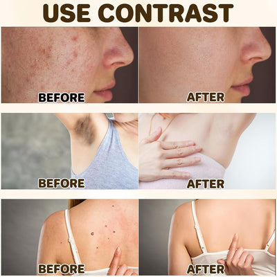 2Pcs Powerful All-Body Skin 𝐓𝐫𝐞𝐚𝐭𝐦𝐞𝐧𝐭 Cream, Advanced Bee Venom Skin 𝐓𝐫𝐞𝐚𝐭𝐦𝐞𝐧𝐭 Cream, Bee Venom Skin 𝐓𝐡𝐞𝐫𝐚𝐩𝐲 Cream, Natural Anti-Wrinkle Repair Cream for All Skin Types