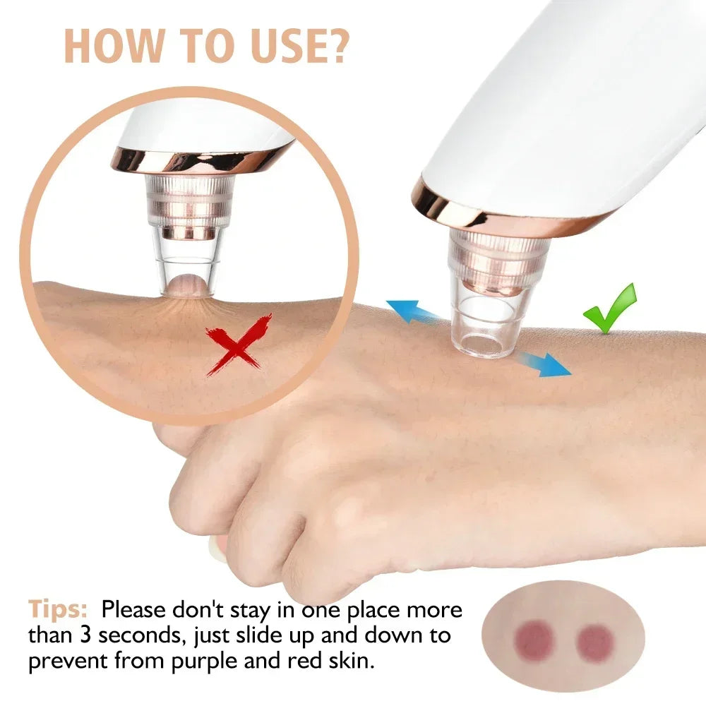 Electric Blackhead Remover Vacuum Suction USB Facial Pore Cleaner Spot Acne Pimple Black Head Extractor Face Clean Skin Care