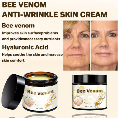 2Pcs Powerful All-Body Skin 𝐓𝐫𝐞𝐚𝐭𝐦𝐞𝐧𝐭 Cream, Advanced Bee Venom Skin 𝐓𝐫𝐞𝐚𝐭𝐦𝐞𝐧𝐭 Cream, Bee Venom Skin 𝐓𝐡𝐞𝐫𝐚𝐩𝐲 Cream, Natural Anti-Wrinkle Repair Cream for All Skin Types